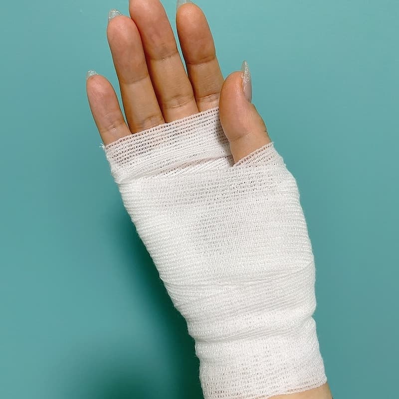 猫に傷つけられた手に包帯を巻いてある